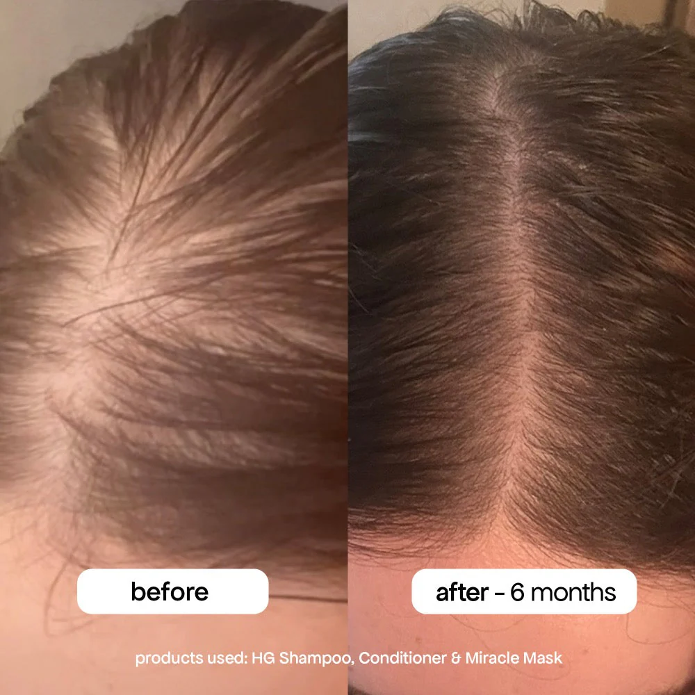 Bondi Boost HG Miracle Hair Mask 250ml - Image 4
