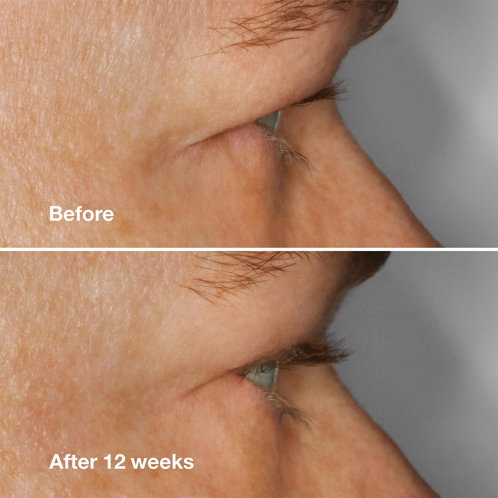 Clinique High Impact Lash Amplifying Serum 10g - Image 3