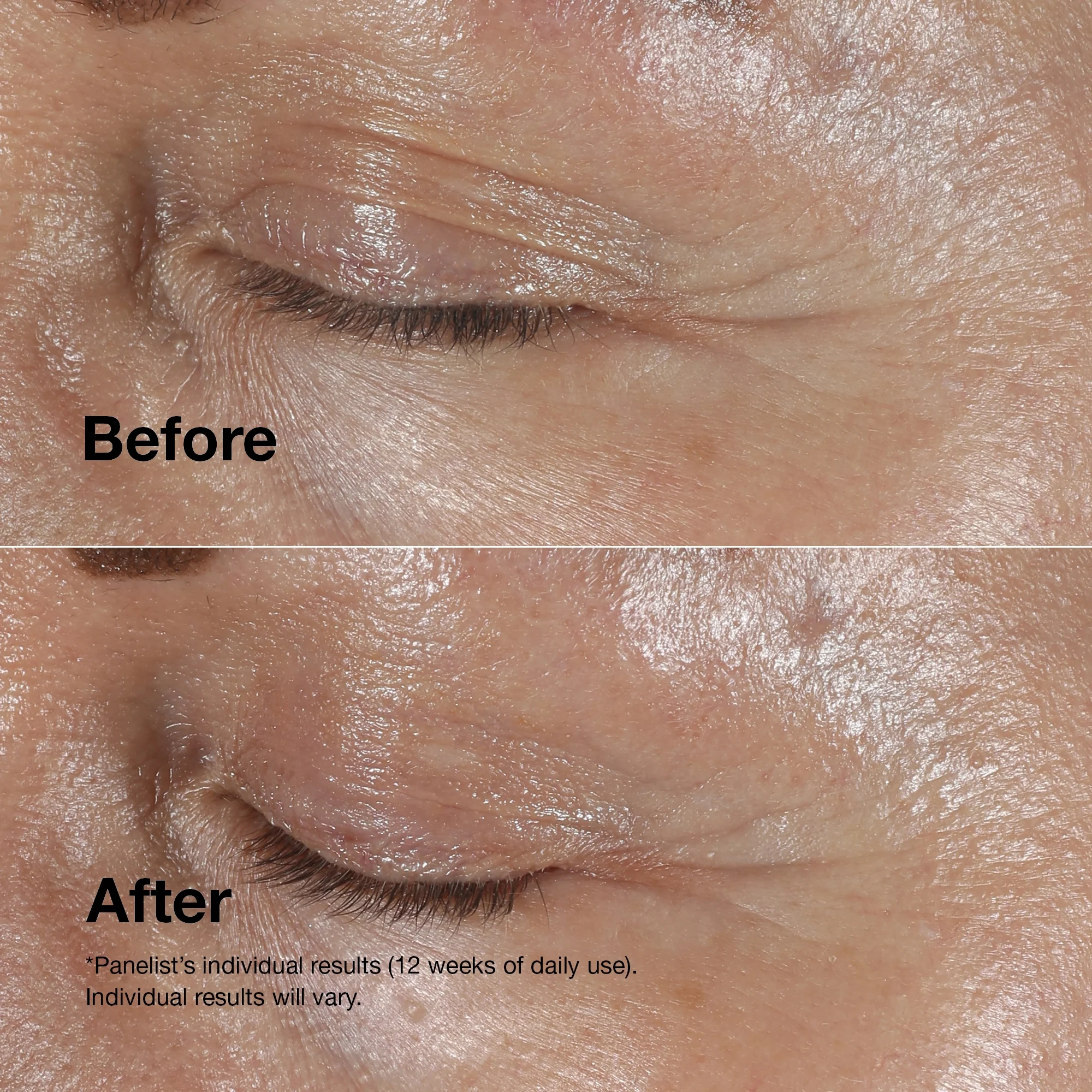 Clinique Smart Clinical Repair Wrinkle Correcting Eye Cream 15ml - Image 3