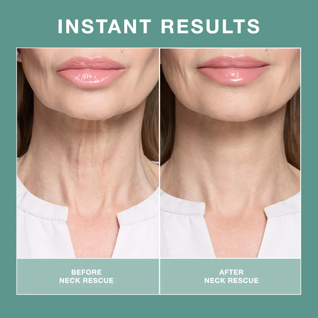 Contours Rx NECK RESCUE 30 Strips - Image 7
