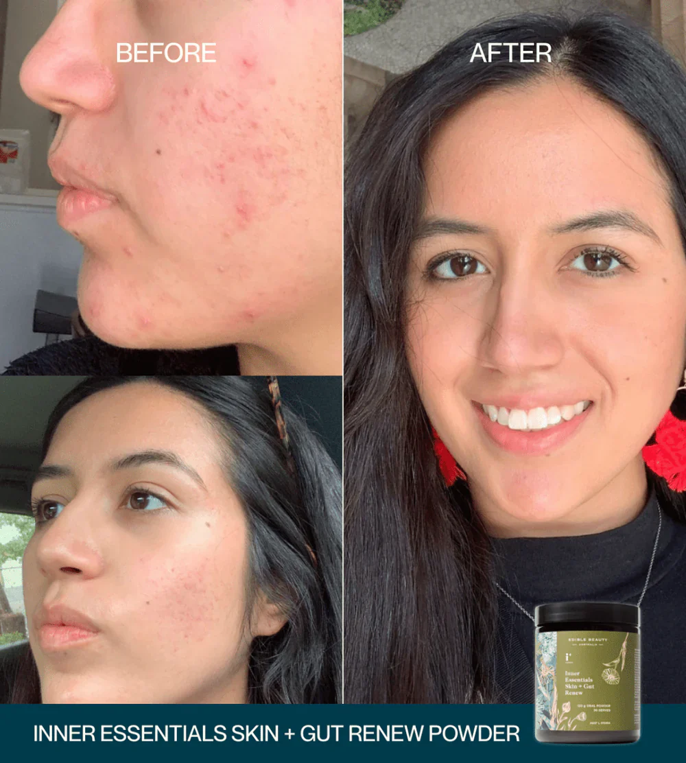 Edible Beauty Inner Essentials - Skin + Gut Renew Powder 120g - Image 5