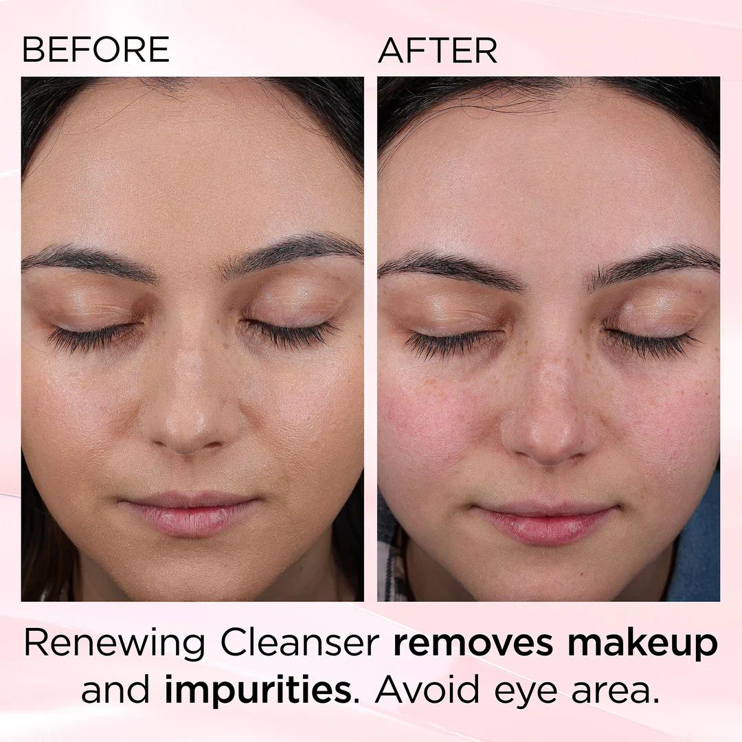 Elizabeth Arden Ceramide Skin Renewing Cleanser 125ml - Image 9