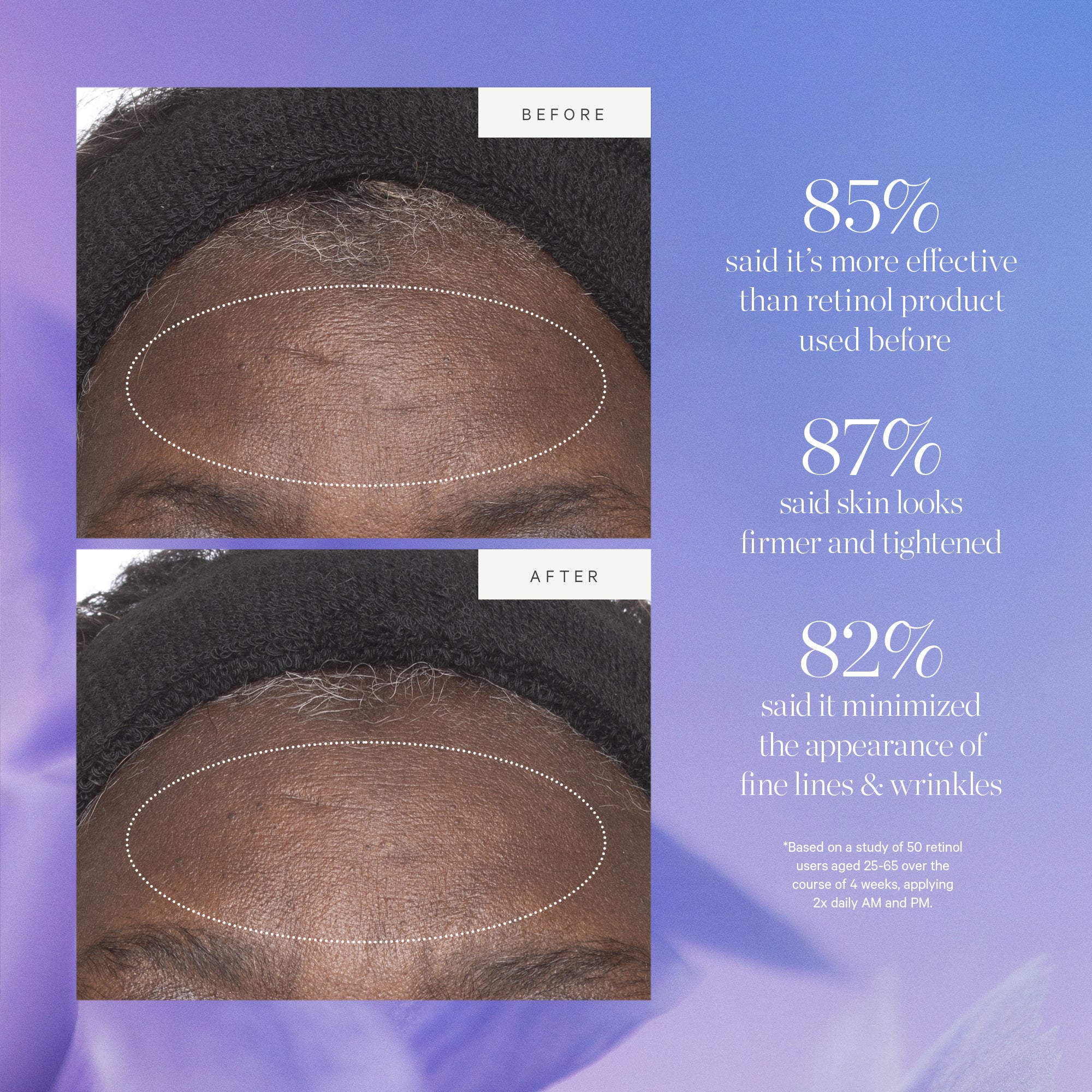 KORA Organics Plant Stem Cell Retinol Alternative Moisturizer 50ml - Image 10