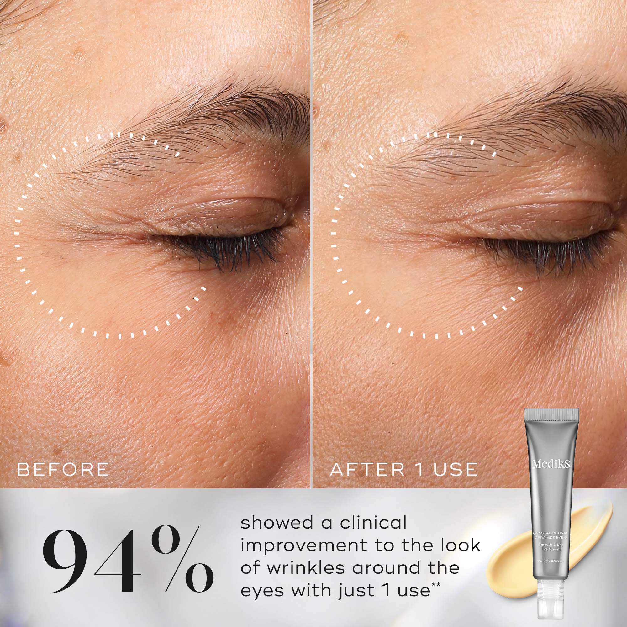 Medik8 Crystal Retinal Ceramide Eye 10 15ml - Image 5