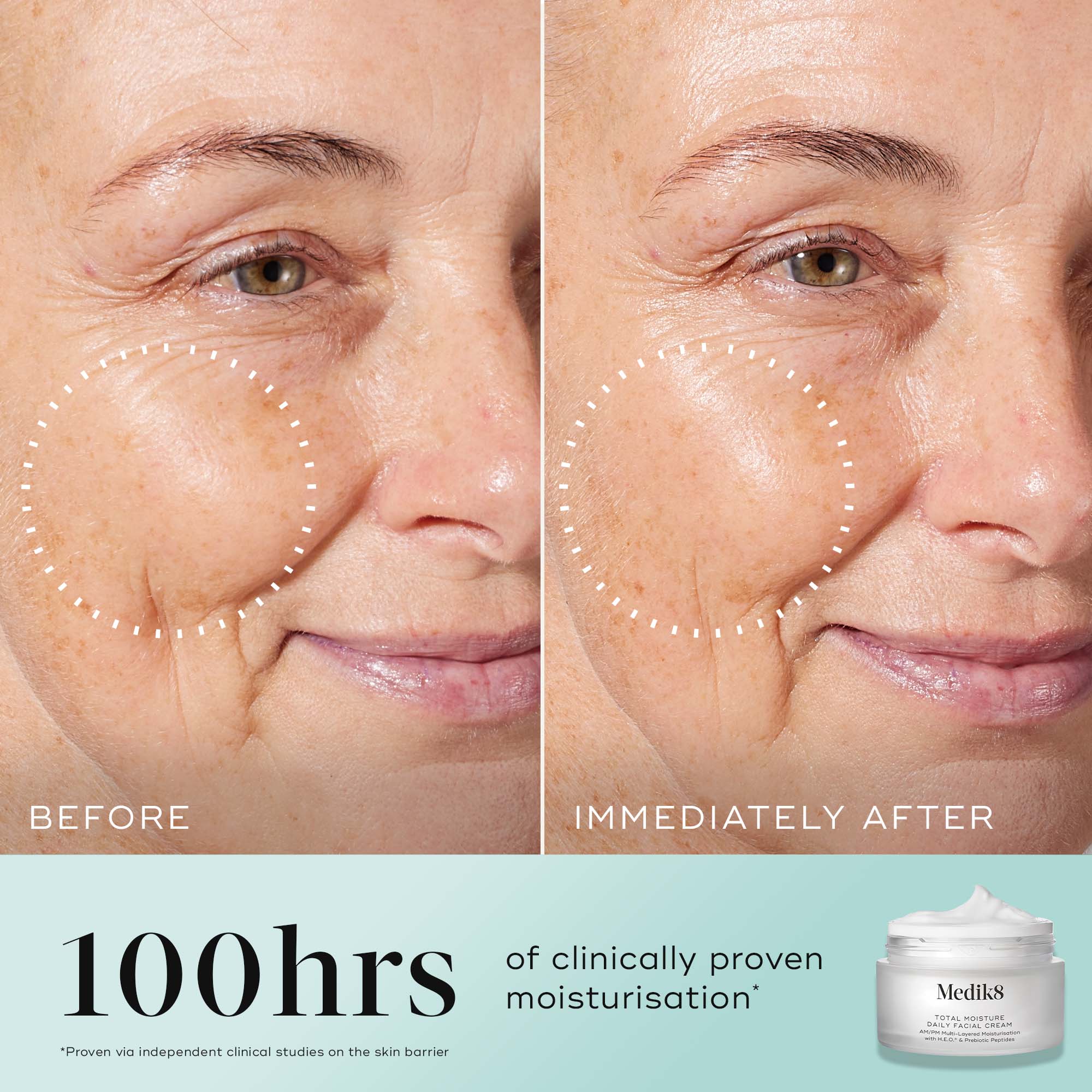 Medik8 Total Moisture Daily Facial Cream Refill 50ml - Image 3