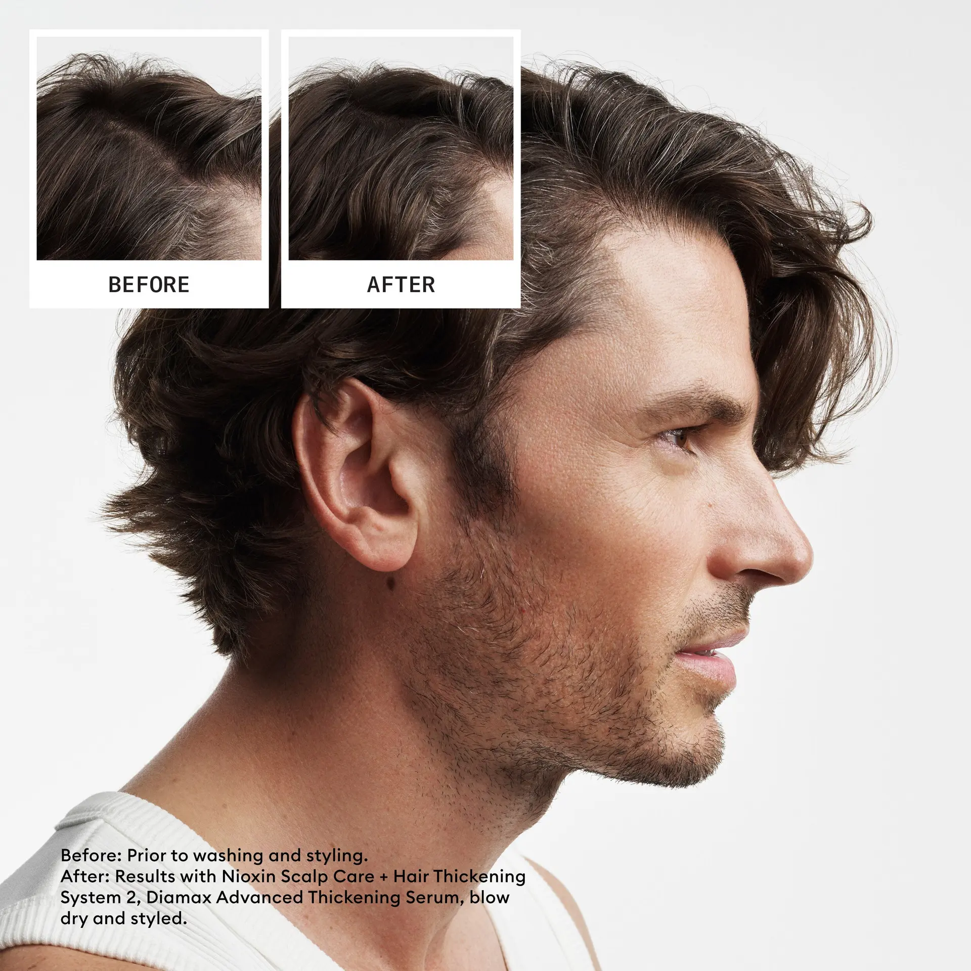 Nioxin Scalp + Hair Thickening System 2 Trial Kit - Image 6