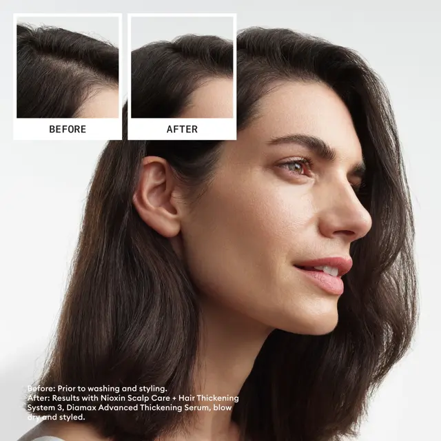 Nioxin Scalp + Hair Thickening System 3 Full Size Kit - Image 6
