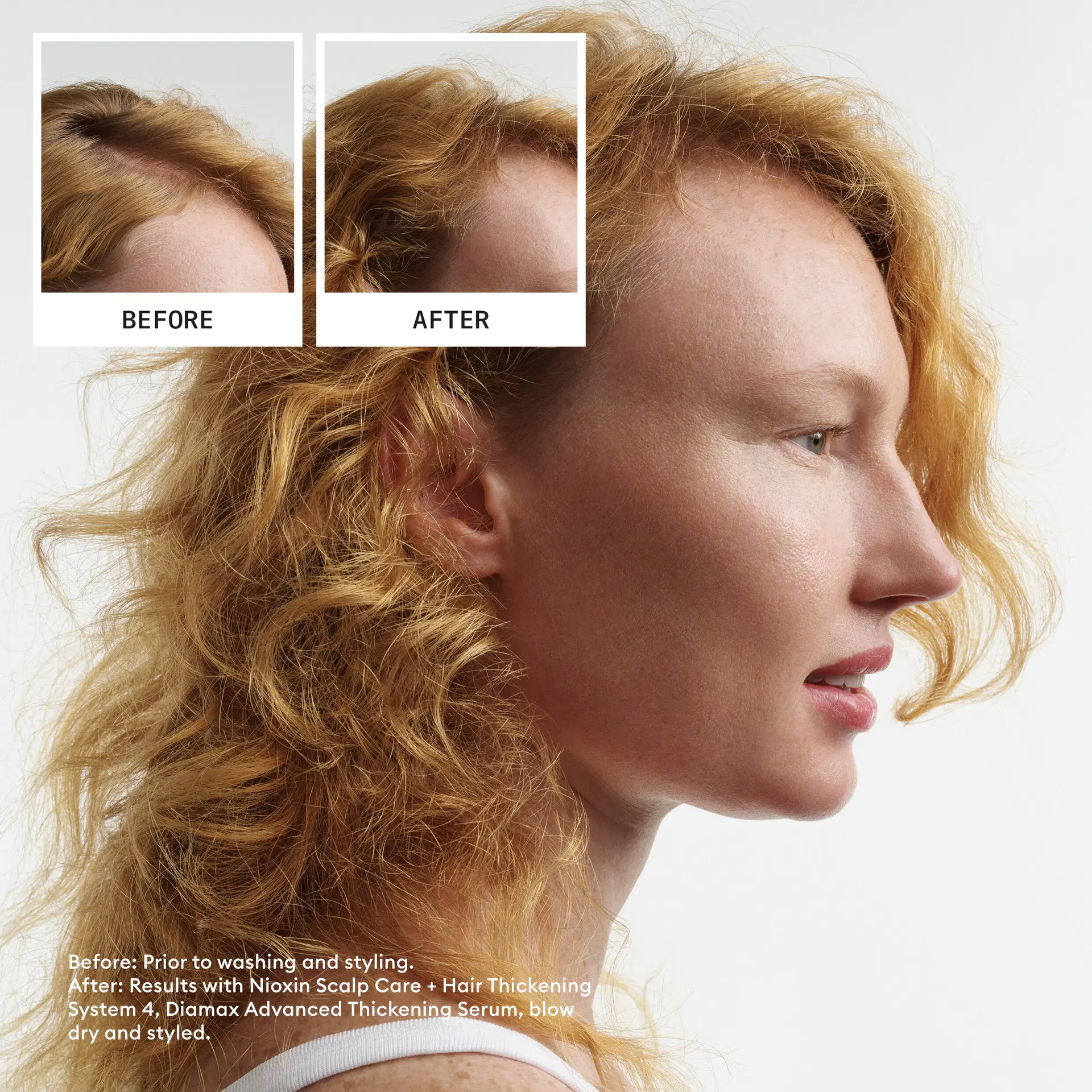 Nioxin Scalp + Hair Thickening System 4 Trial Kit - Image 4