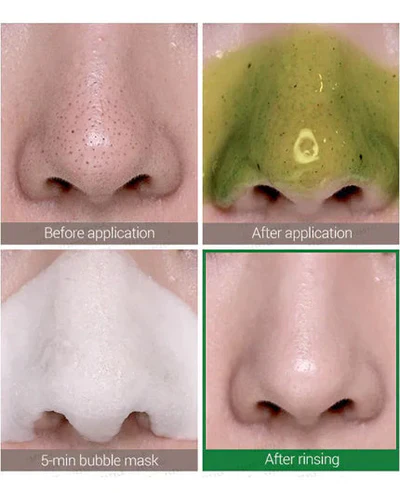 SOME BY MI Miracle Bye Bye 30 Days Blackhead Miracle Green Tea Tox Bubble Cleanser 120g - Image 5