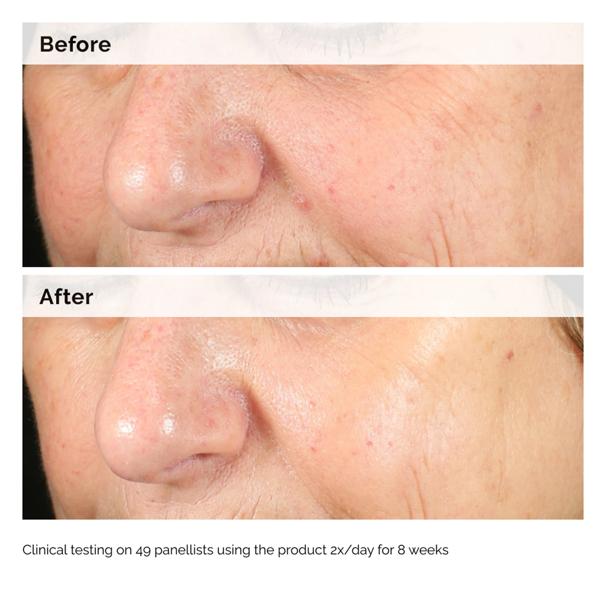 The Ordinary Alpha Arbutin 2% + HA 30ml - Image 11
