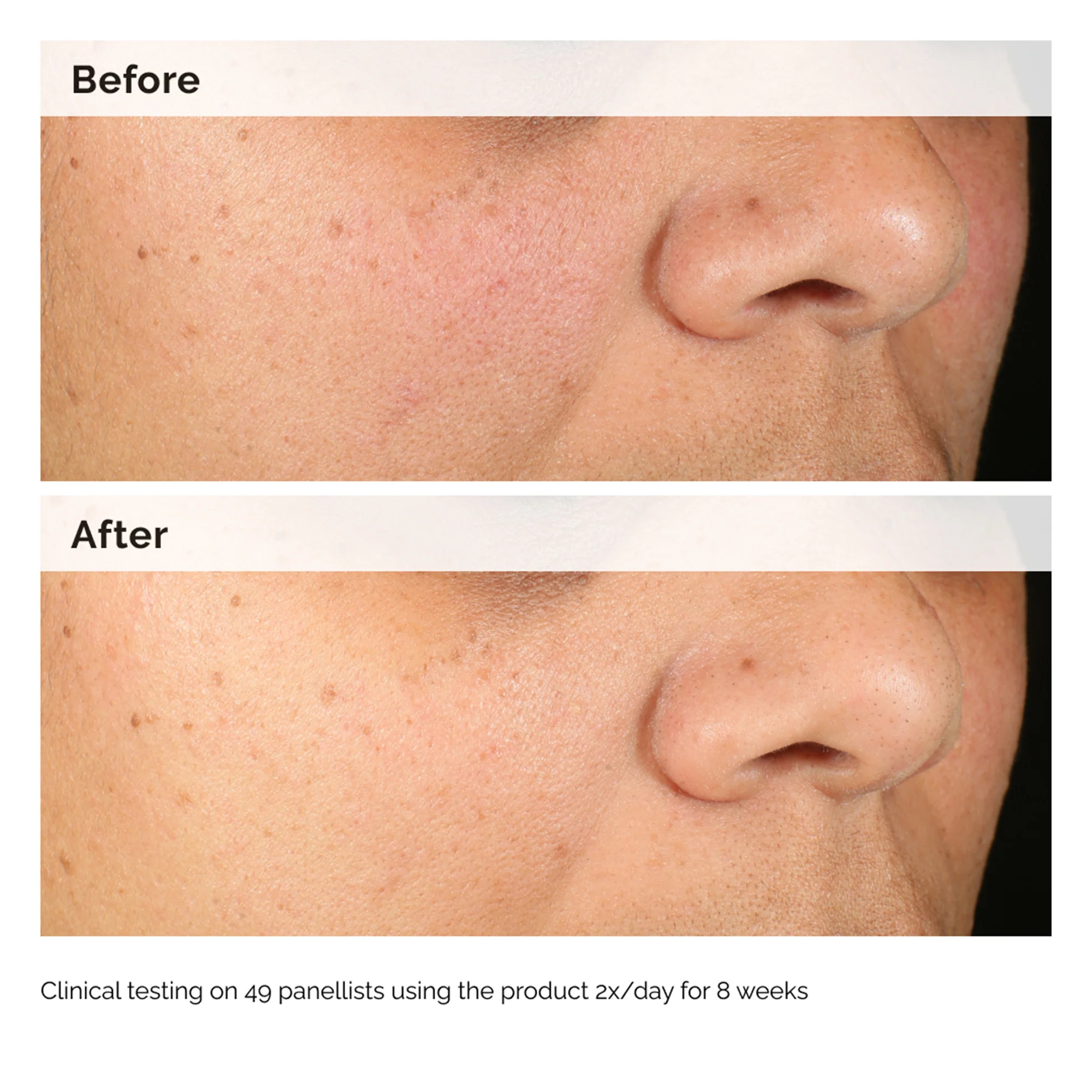 The Ordinary Alpha Arbutin 2% + HA 30ml - Image 8