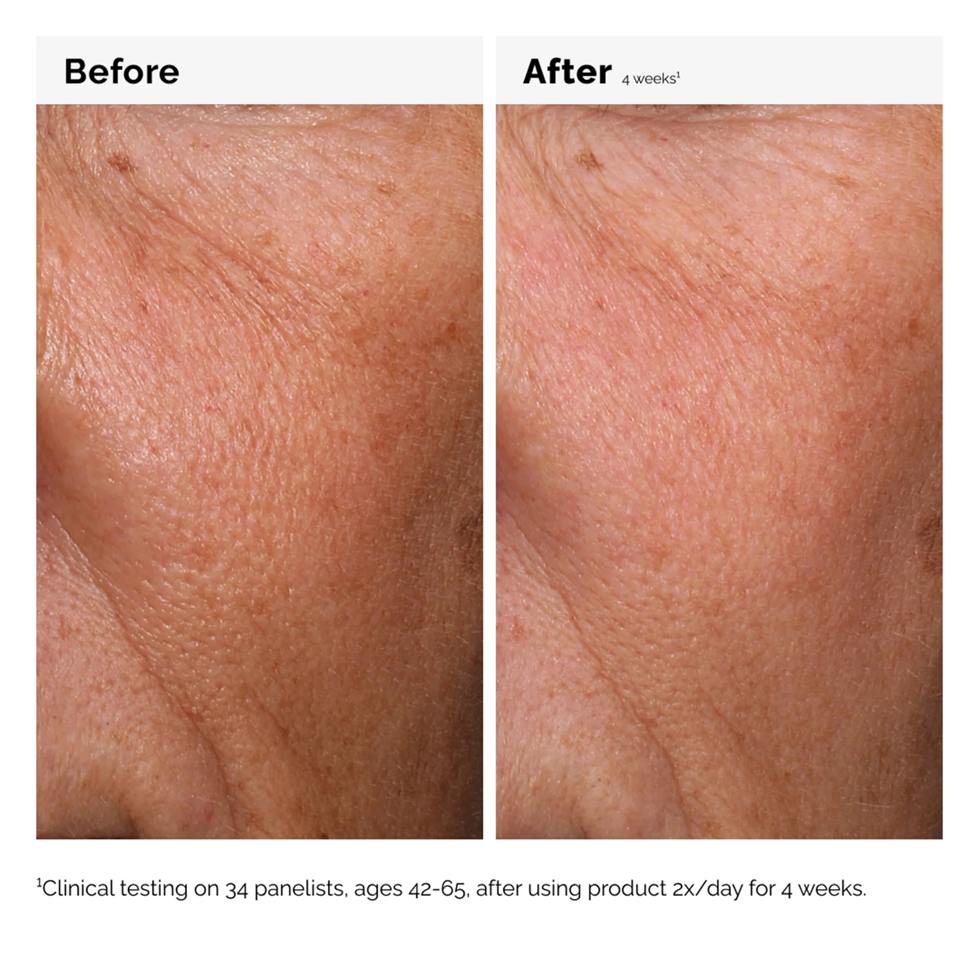 The Ordinary Hyaluronic Acid 2% + B5 30ml - Image 5