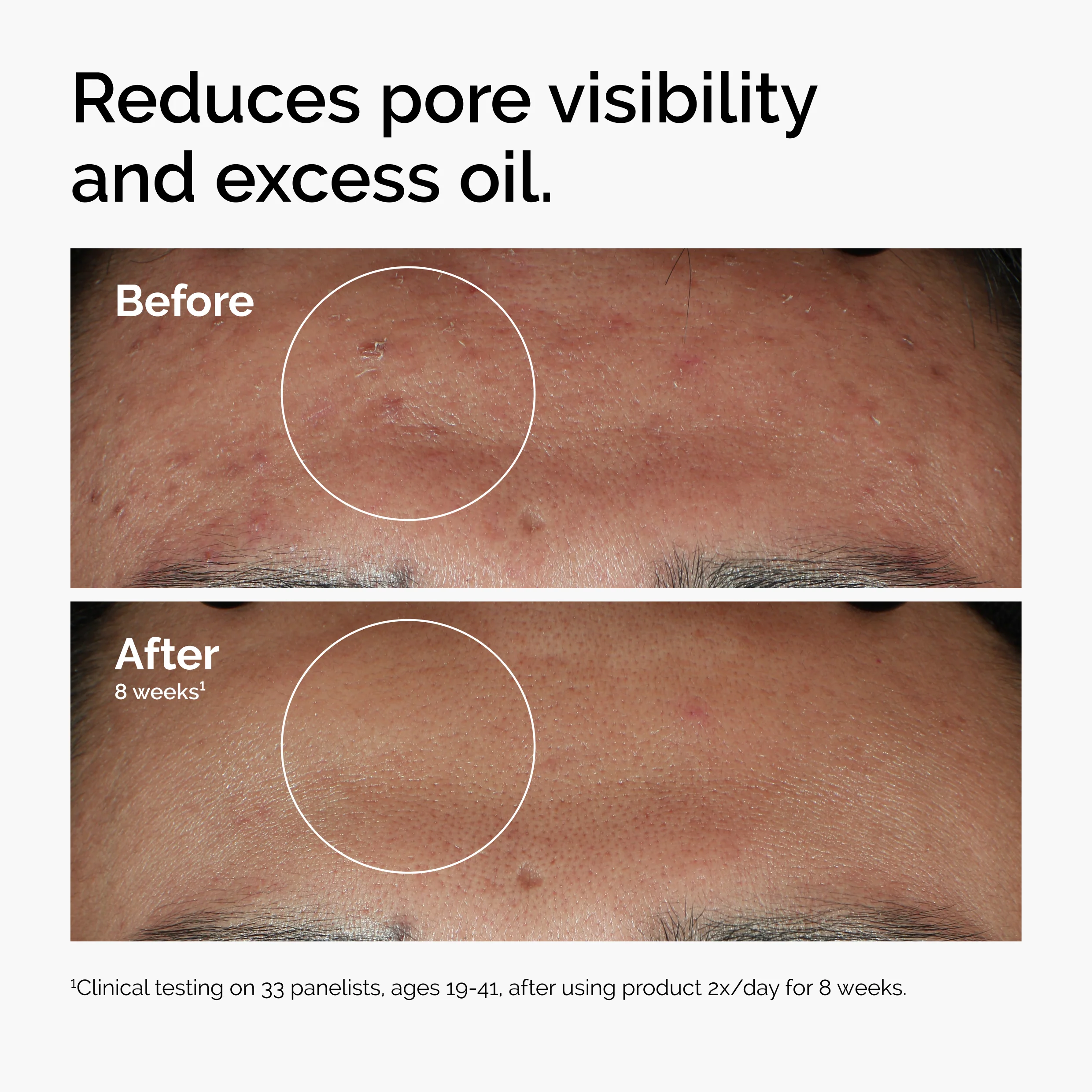 The Ordinary Niacinamide 10% + Zinc 1% 30ml - Image 8