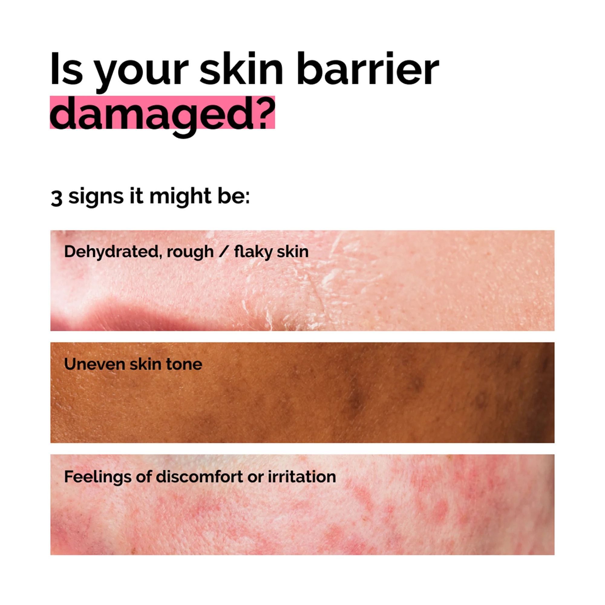 The Ordinary Soothing & Barrier Support Serum 30ml - Image 8