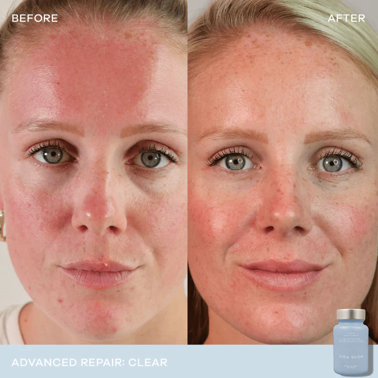 Vida Glow Clear Advanced Repair - 30 capsules 2 Pack - Image 2