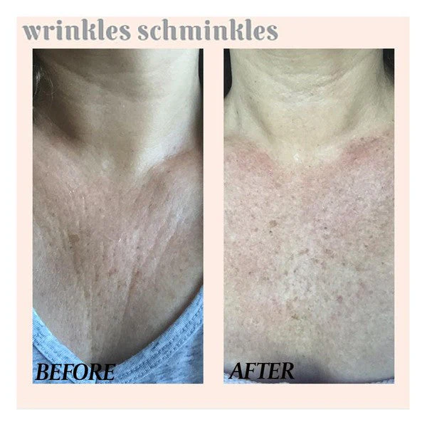 Wrinkles Schminkles Chest Wrinkle Patch - Image 2