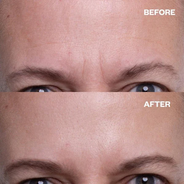 Wrinkles Schminkles Forehead Wrinkle Patches - 2 Patches - Image 5