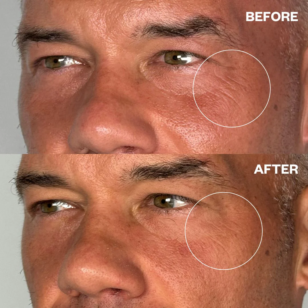 Wrinkles Schminkles Men's Pro Eye Wrinkle Patches - 1 Pair - Image 3